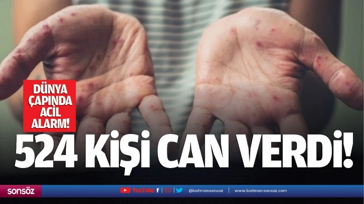 Dünya çapında acil alarm! 524 kişi can verdi!