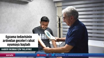 Egzama tedavisinin ardından geceleri rahat uyumaya başladı